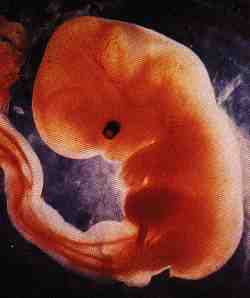 Foetus at 6 weeks